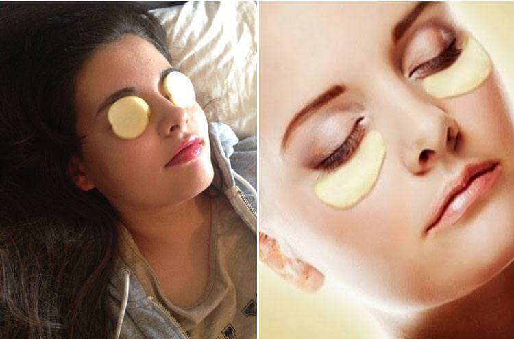 Raw-Potato-for-dark circles